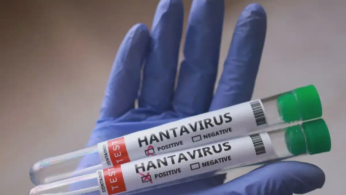 OMS alerta que hantavírus transmite mais no início da doença